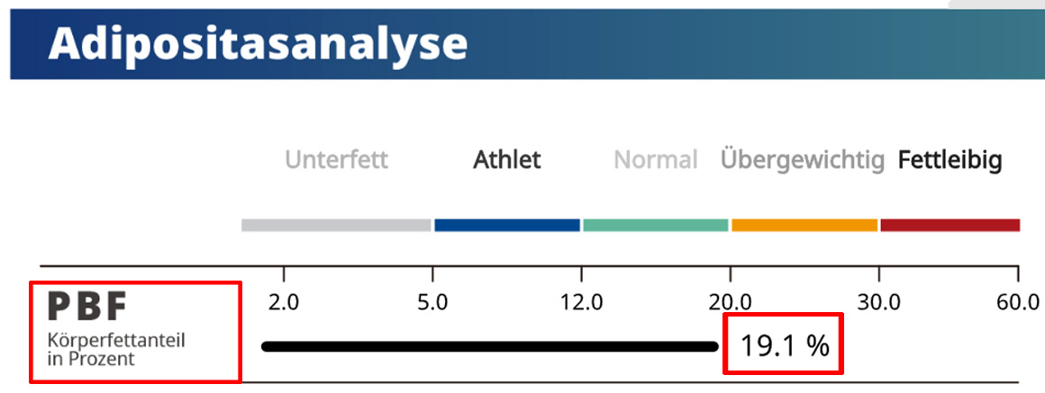 Standard Body Composition Result Sheet Obesity