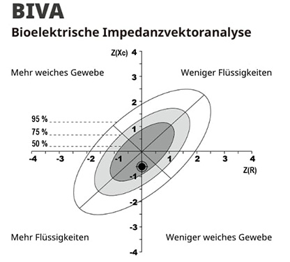 Bioelectrical Impedance Vector Analysis